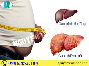 thuoc-tay-hay-thao-duoc-tri-gan-nhiem-mo-tot-hon-1