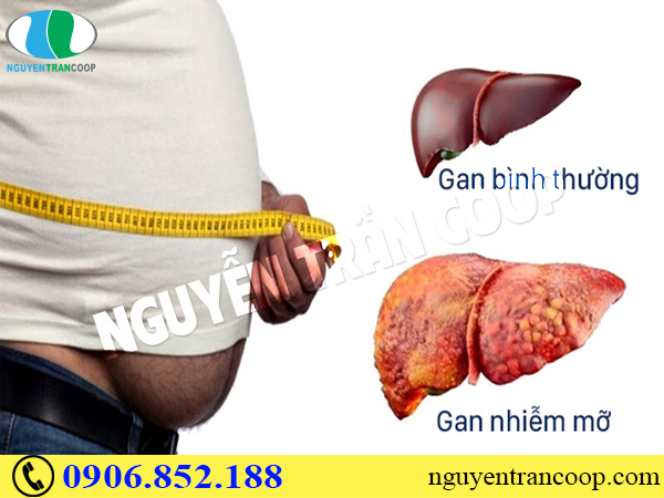 thuoc-tay-hay-thao-duoc-tri-gan-nhiem-mo-tot-hon-1