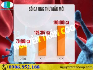 Ung thư gan có chữa được không?