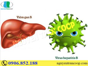 Khả năng lây bệnh viêm gan B và cách phòng tránh