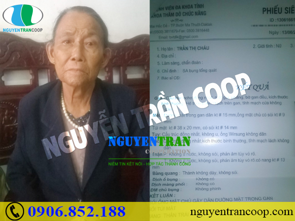 Người thật việc thật - Chia sẻ kết quả dùng Cây An Xoa điều trị bệnh gan